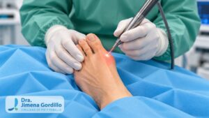 Cirugía laser en juanetes, realmente se refiere a Cirugía percutánea